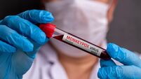 Doctor wearing medical gloves holding a blood tube with positive Monkeypox - Mpox virus Blood Sample.